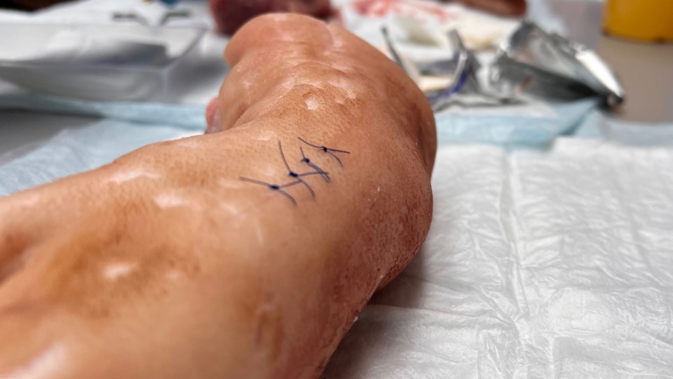 Medicinstuderende lærer bl.a. at sy sår og flænger sammen, når de er til Bland Selv Klinik. Til dette bruges bl.a. grisetæer.