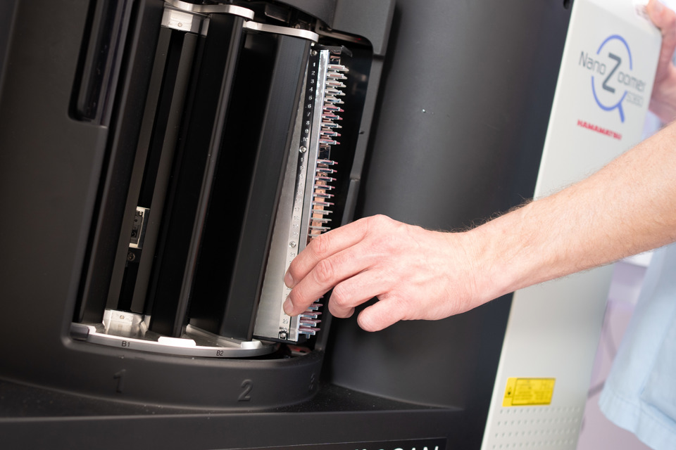 Trin 8: Prøveglassene vurderes ikke længere i mikroskop, men indscannes digitalt så de kan ses på computerskærm.