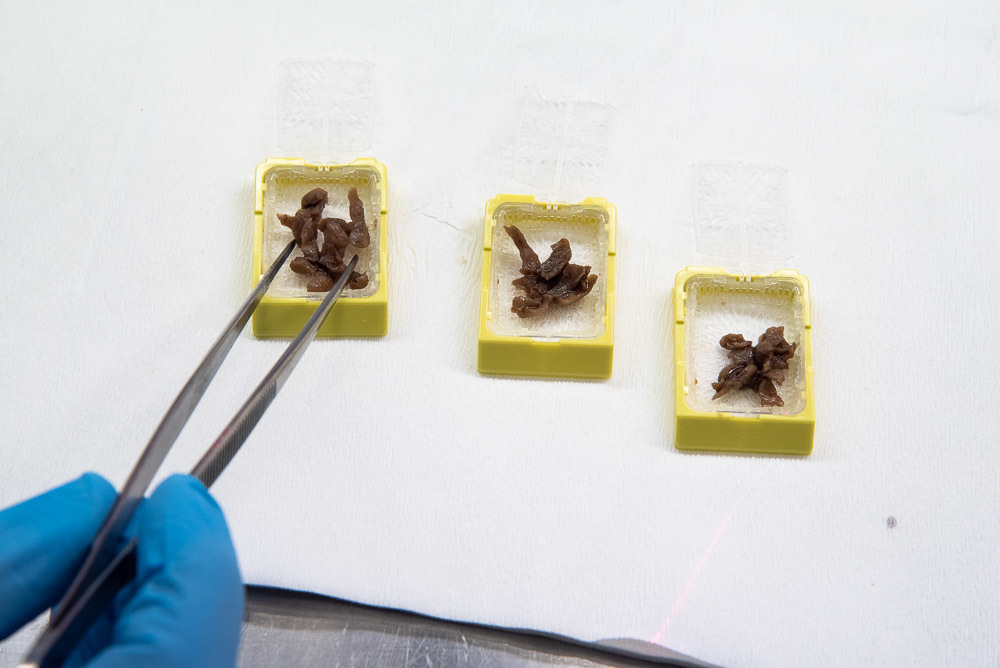 Trin 2A: Vævsstykkerne beskrives og lægges i små plastikkapsler, som behandles på en maskine, som fjerner vandet i vævet og erstattes det med paraffin.