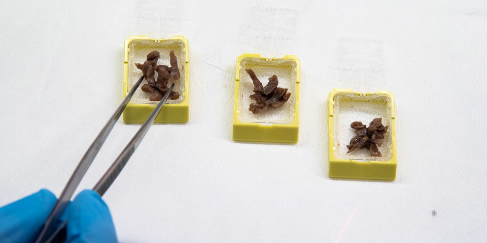 Trin 2A: Vævsstykkerne beskrives og lægges i små plastikkapsler, som behandles på en maskine, som fjerner vandet i vævet og erstattes det med paraffin.