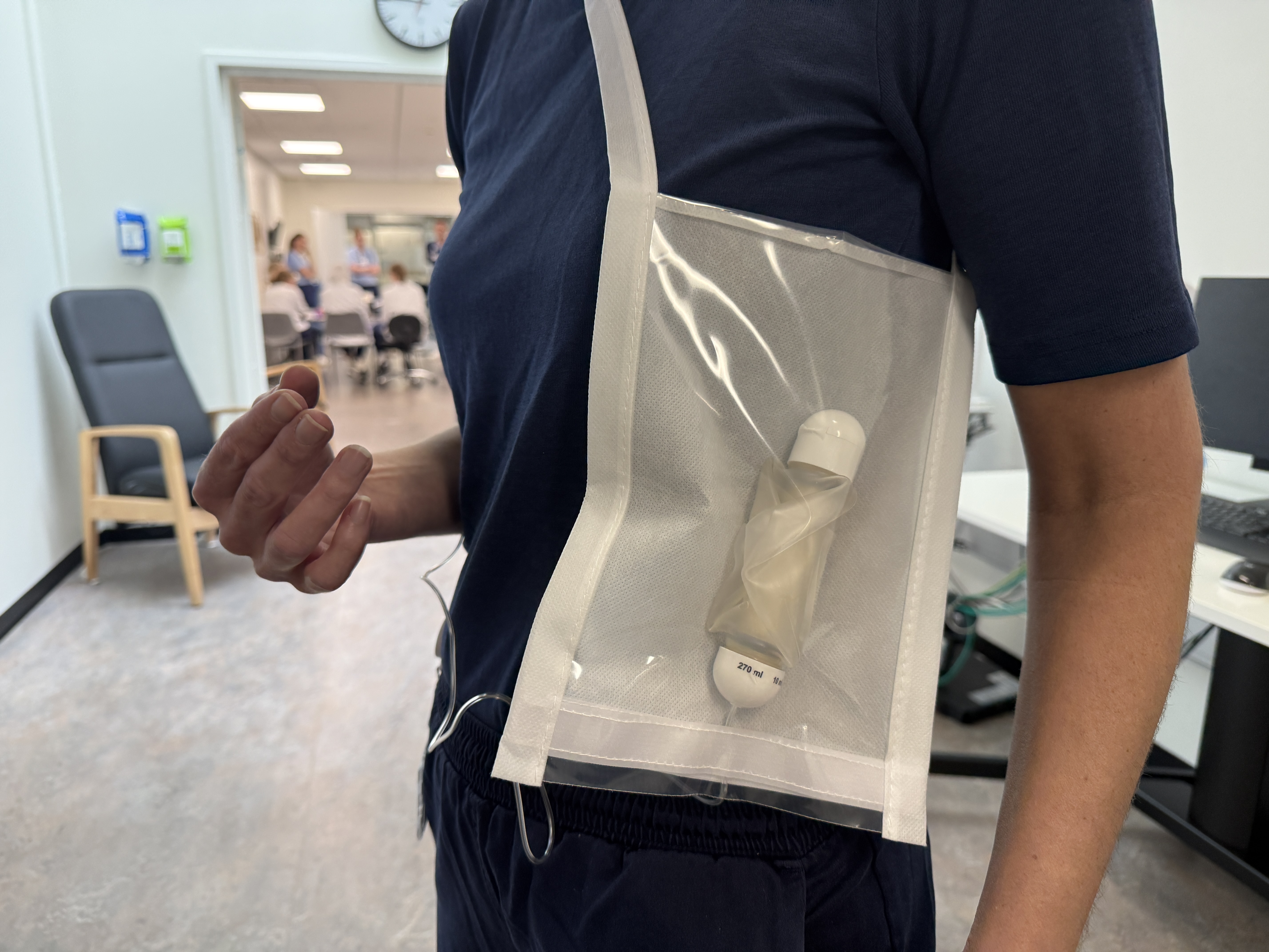 Sådan kan pumpen hænge i tasken på patienten derhjemme