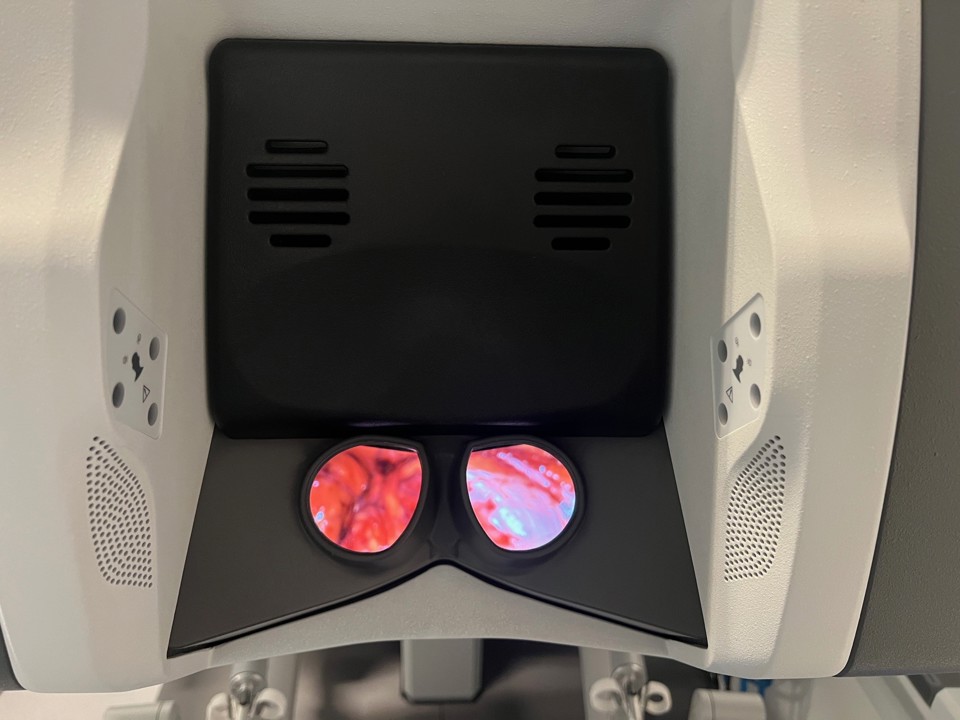 Når kirugen opererer er det de her linser, han kigger i.