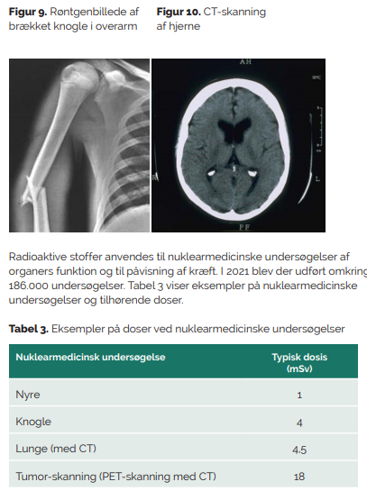 Medicinsk bestråling