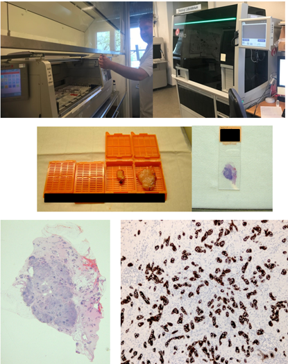 Flere billeder af farvningsprocessen og farvede snit ses i et mikroskop