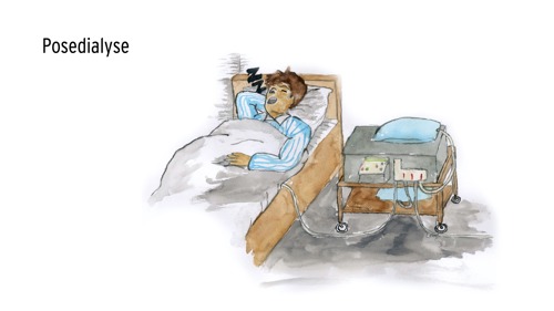 Tegning af person, der ligger i sengen og sover med dialysemaskine ved siden af sengen.